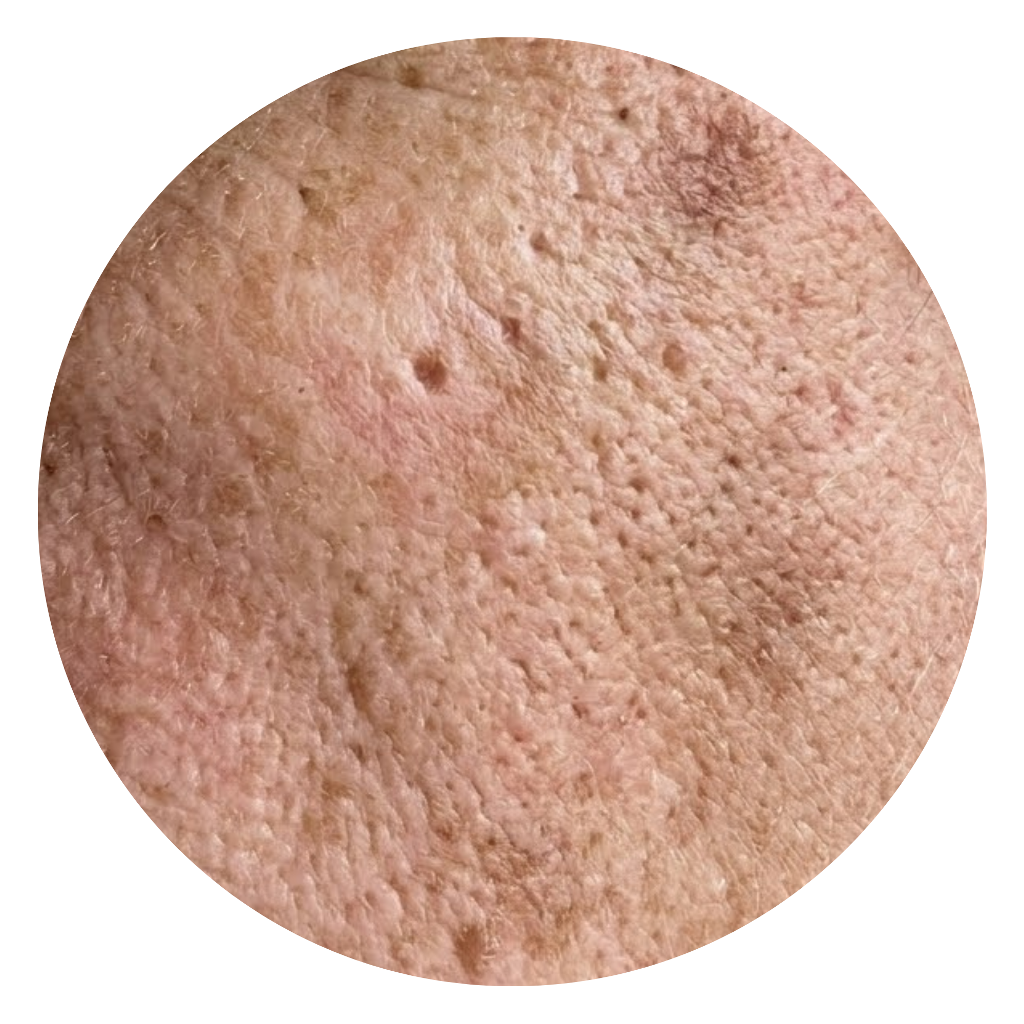 מרקם לא אחיד